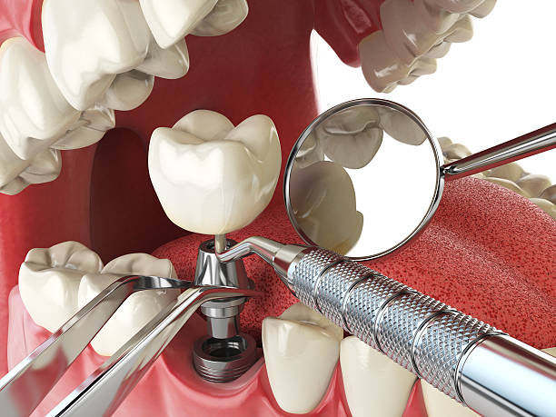 Best Emergency Dental Surgery in Lexington, NE